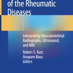 Diagnostic Radiology of the Rheumatic Diseases (Katz) 1st edition (2020)