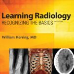 Learning Radiology: Recognizing the Basics (Herring) 3rd editon (2016)