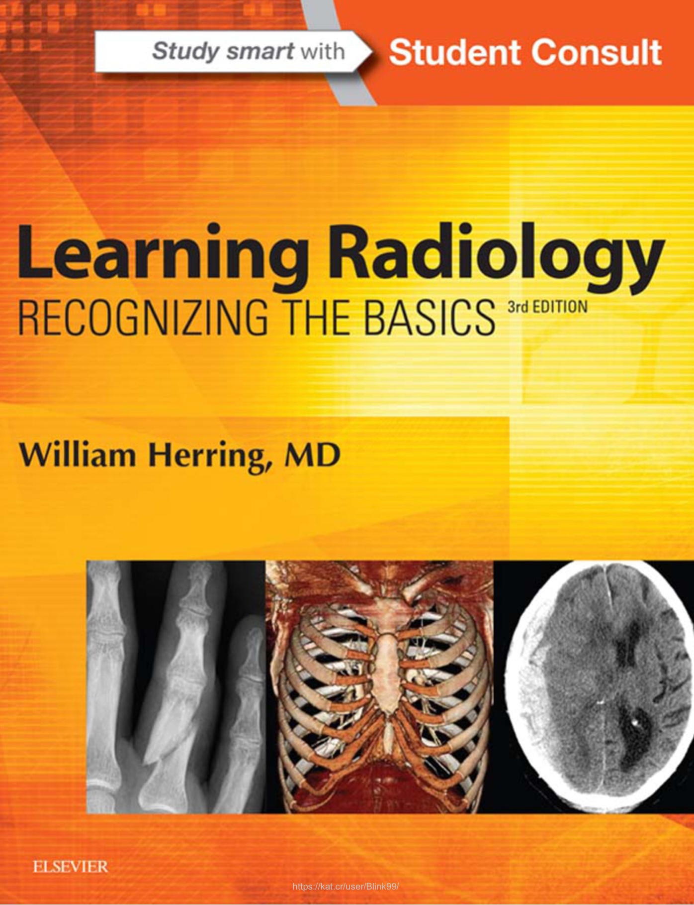 Learning Radiology: Recognizing the Basics (Herring) 3rd editon (2016)