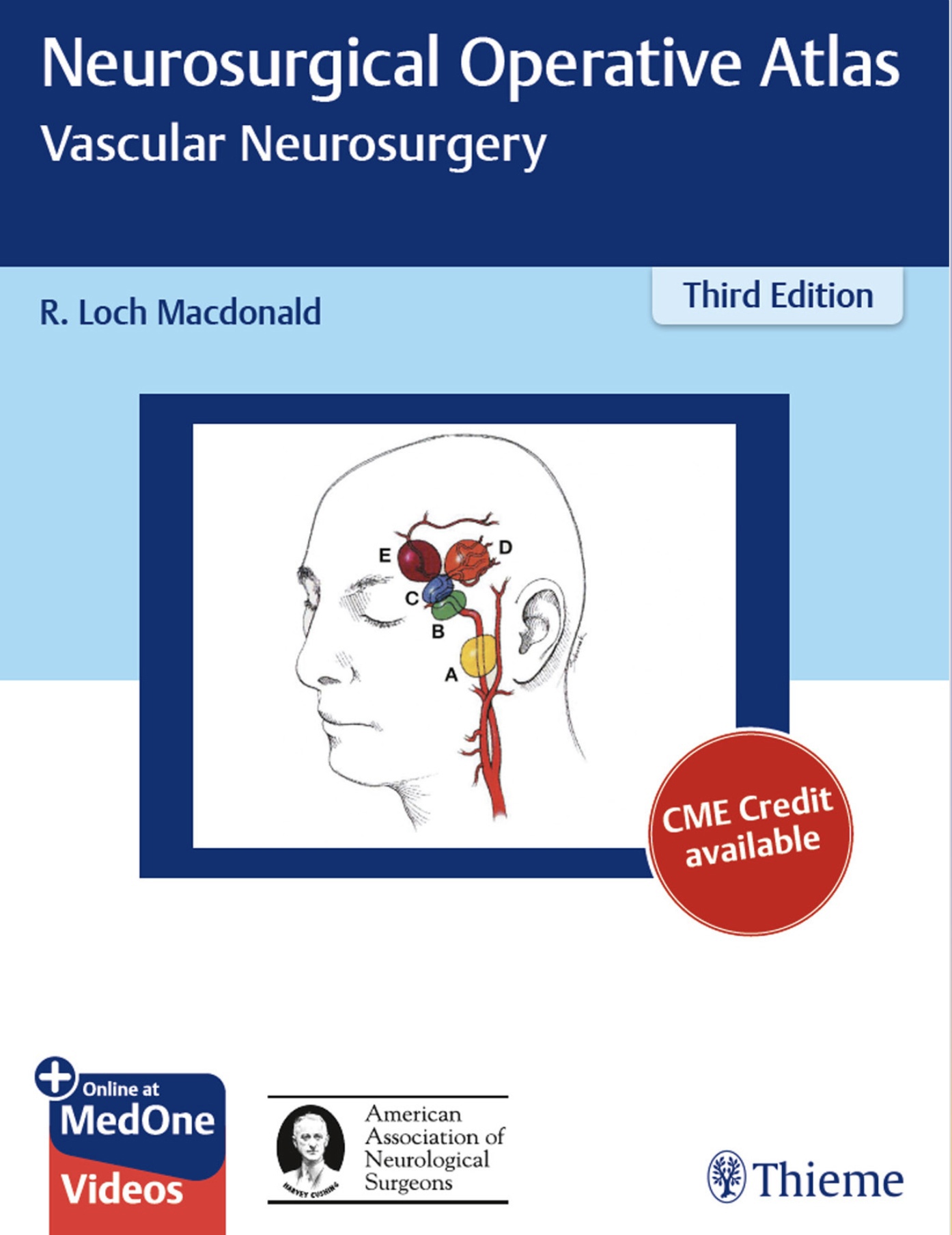 Neurosurgical Operative Atlas. Vascular Neurosurgery (Macdonald) 3rd edition (2019)