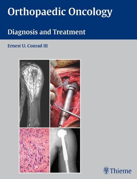 Orthopaedic Oncology. Diagnosis and Treatment (Conrad) 1st edition (2008)