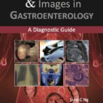 Clinical Challenges & Images in Gastroenterology. A Diagnostic Guide (Ng) 1st edition (2018)