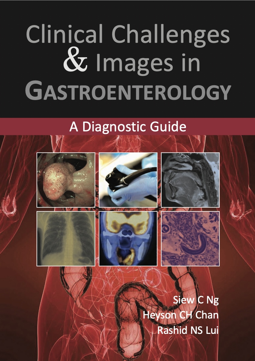 Clinical Challenges & Images in Gastroenterology. A Diagnostic Guide (Ng) 1st edition (2018)