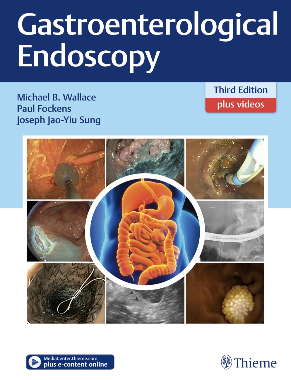 Gastroenterological Endoscopy (Fockens) 3rd edition (2018)