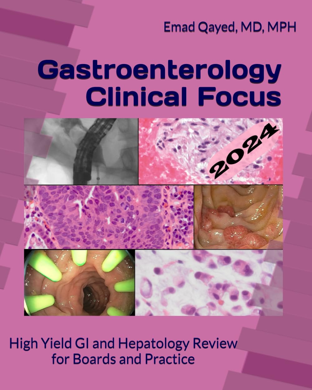 Gastroenterology Clinical Focus High Yield GI and Hepatology Review. For Boards and Practice (Qayed) 3rd edition (2023)