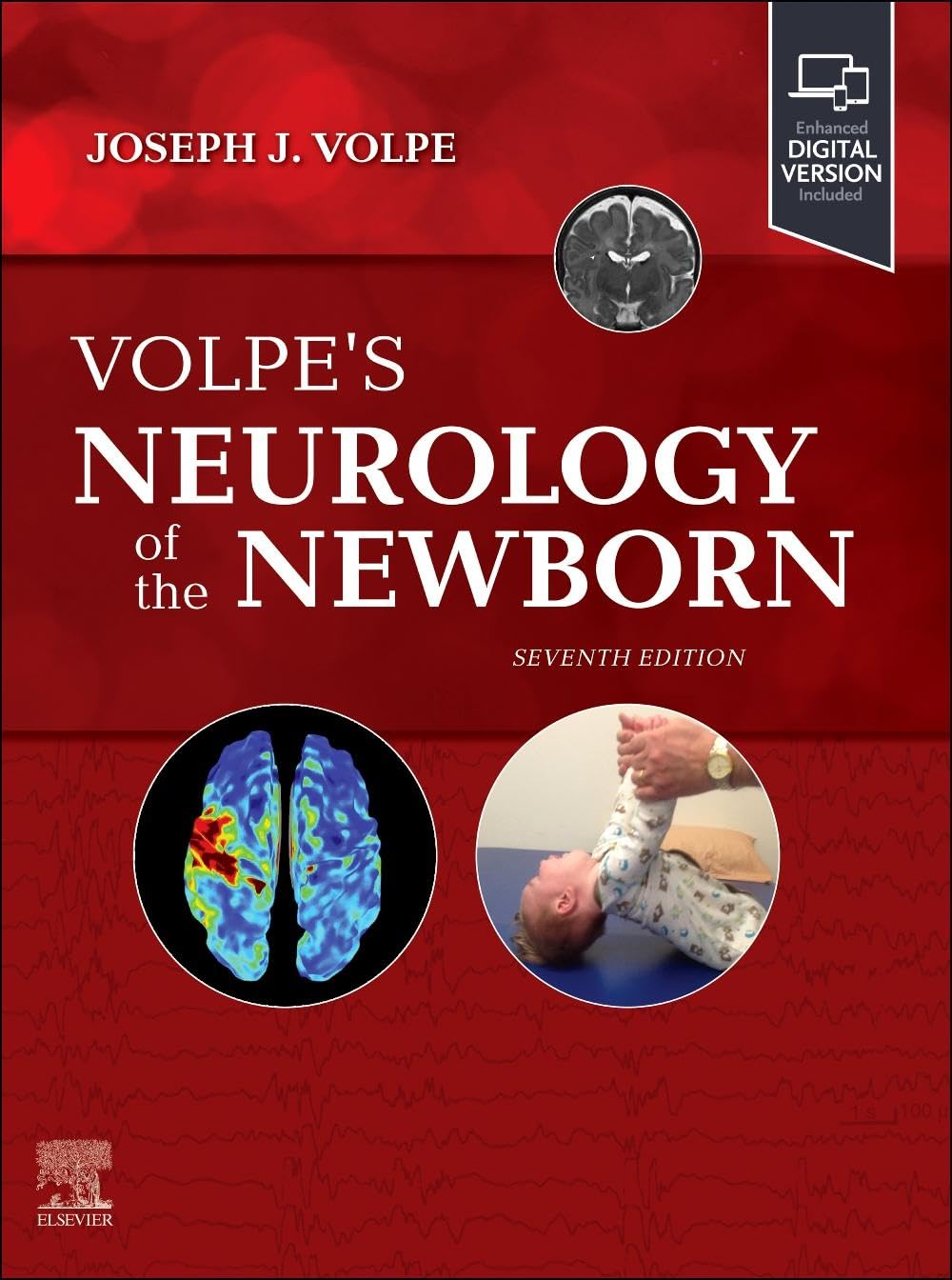 Volpe’s Neurology of the Newborn (Volpe) 7th edition (2024)