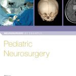 Pediatric Neurosurgery (Selden) 1st edition (2019)