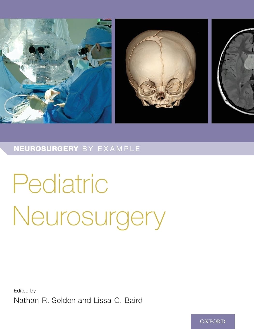 Pediatric Neurosurgery (Selden) 1st edition (2019)