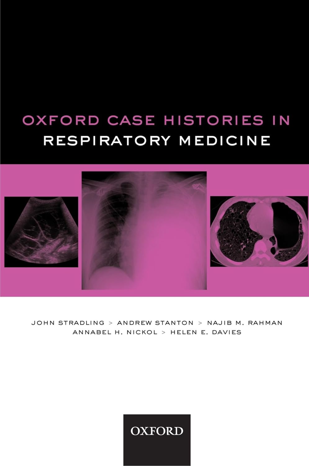 Oxford Case Histories in Respiratory Medicine 1st Edition