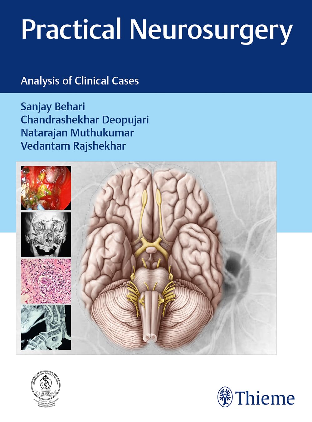 Practical Neurosurgery: Analysis of Clinical Cases (Behari) 2nd edition (2019)