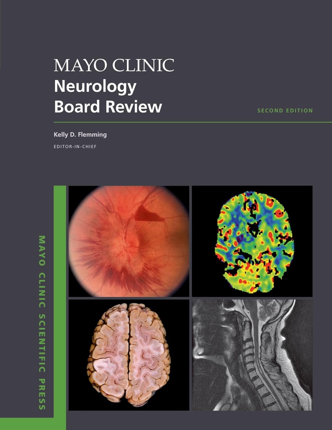 Mayo Clinic Neurology Board Review (Flemming) 2nd edition (2022)