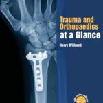 Trauma and Orthopedics at a Glance (Willmott) 1st editionn (2016)