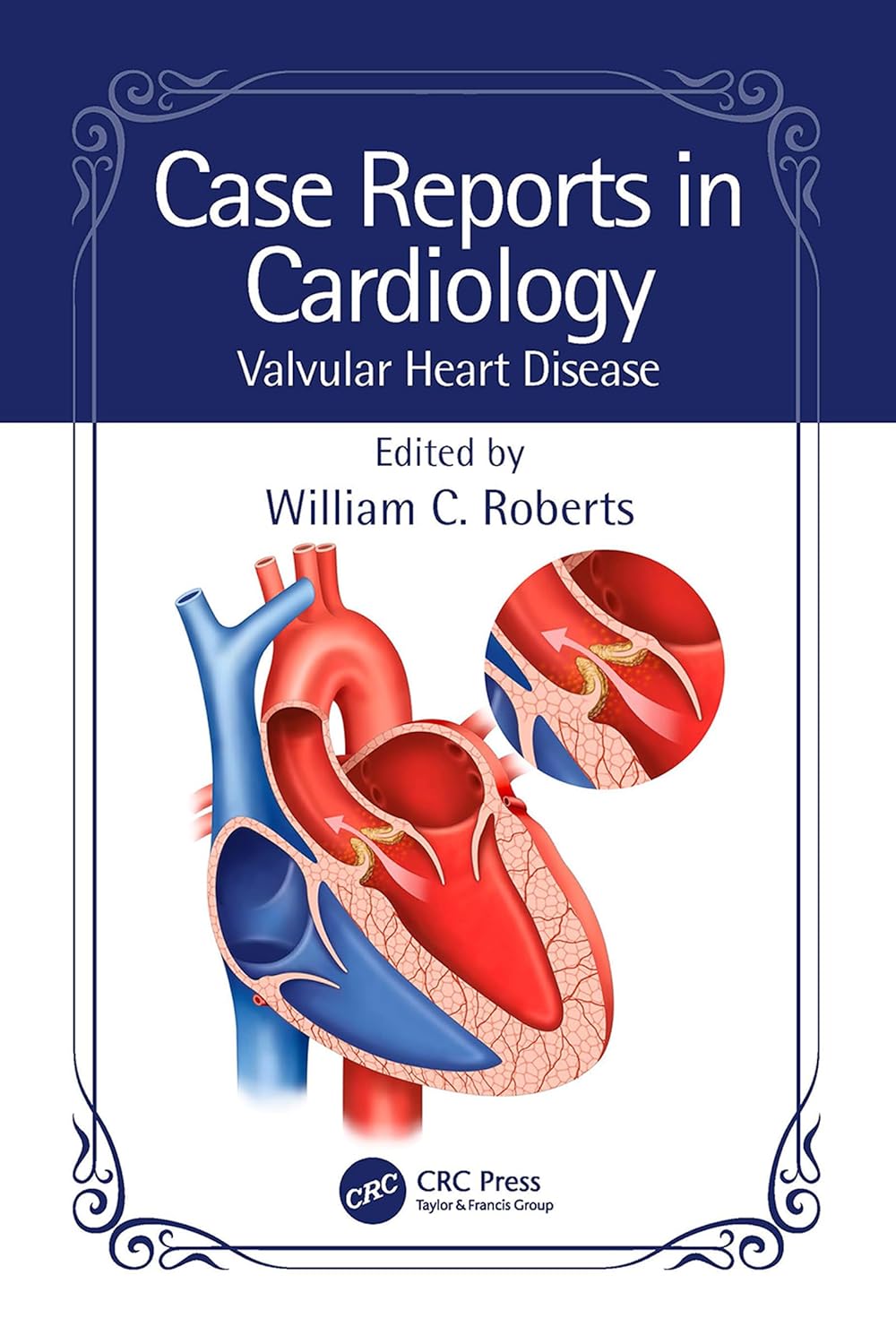 Case Reports in Cardiology; Valvular Heart Disease (Roberts) 1st edition (2023)