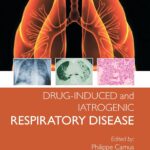 Drug-induced and Iatrogenic Respiratory Disease (Camus) 1st edition (2010)