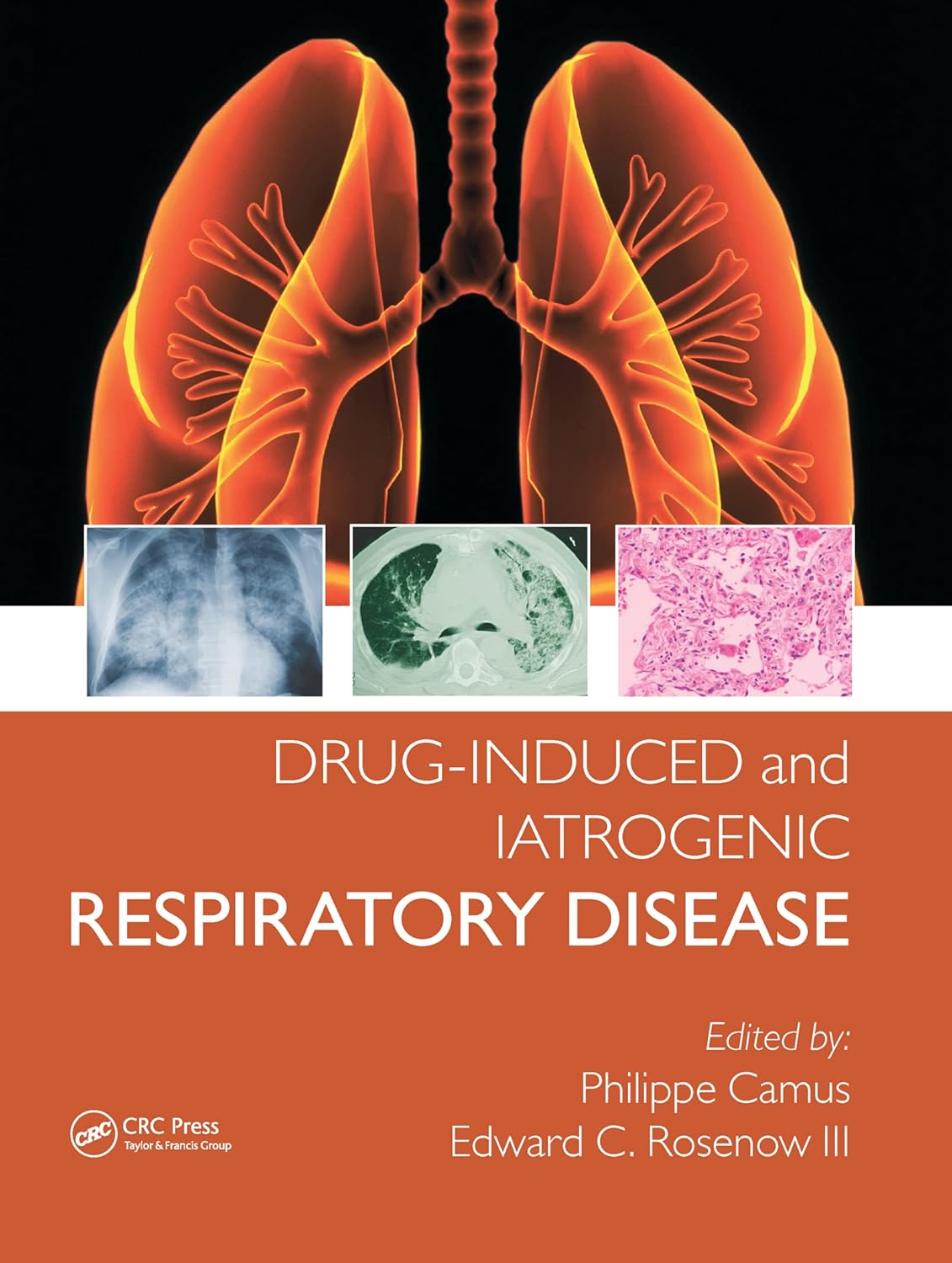 Drug-induced and Iatrogenic Respiratory Disease (Camus) 1st edition (2010)