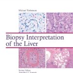 Biopsy Interpretation of the Liver (Torbenson) 1st edition (2014)