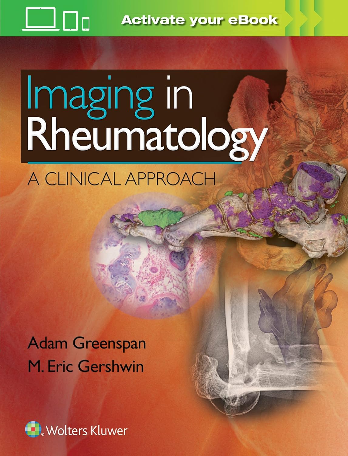 Imaging in Rheumatology. A Clinical Approach (Greenspan) 1st edition (2018)