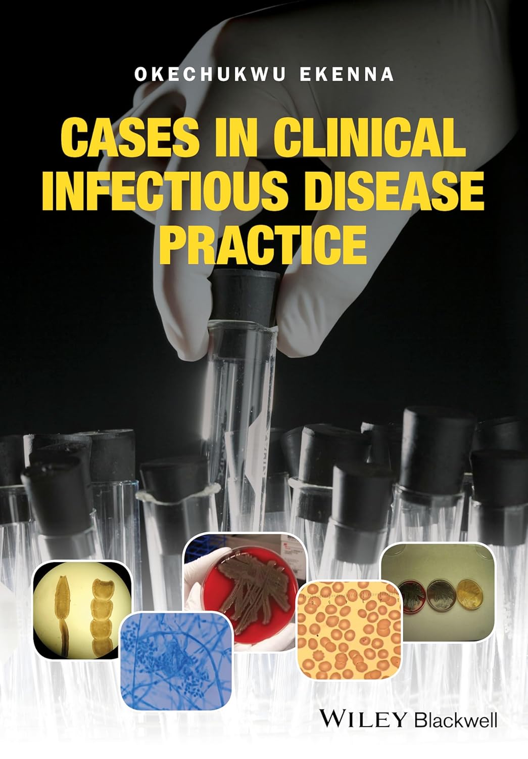 Cases in Clinical Infectious Disease Practice (Ekenna) 1st edition (2016)