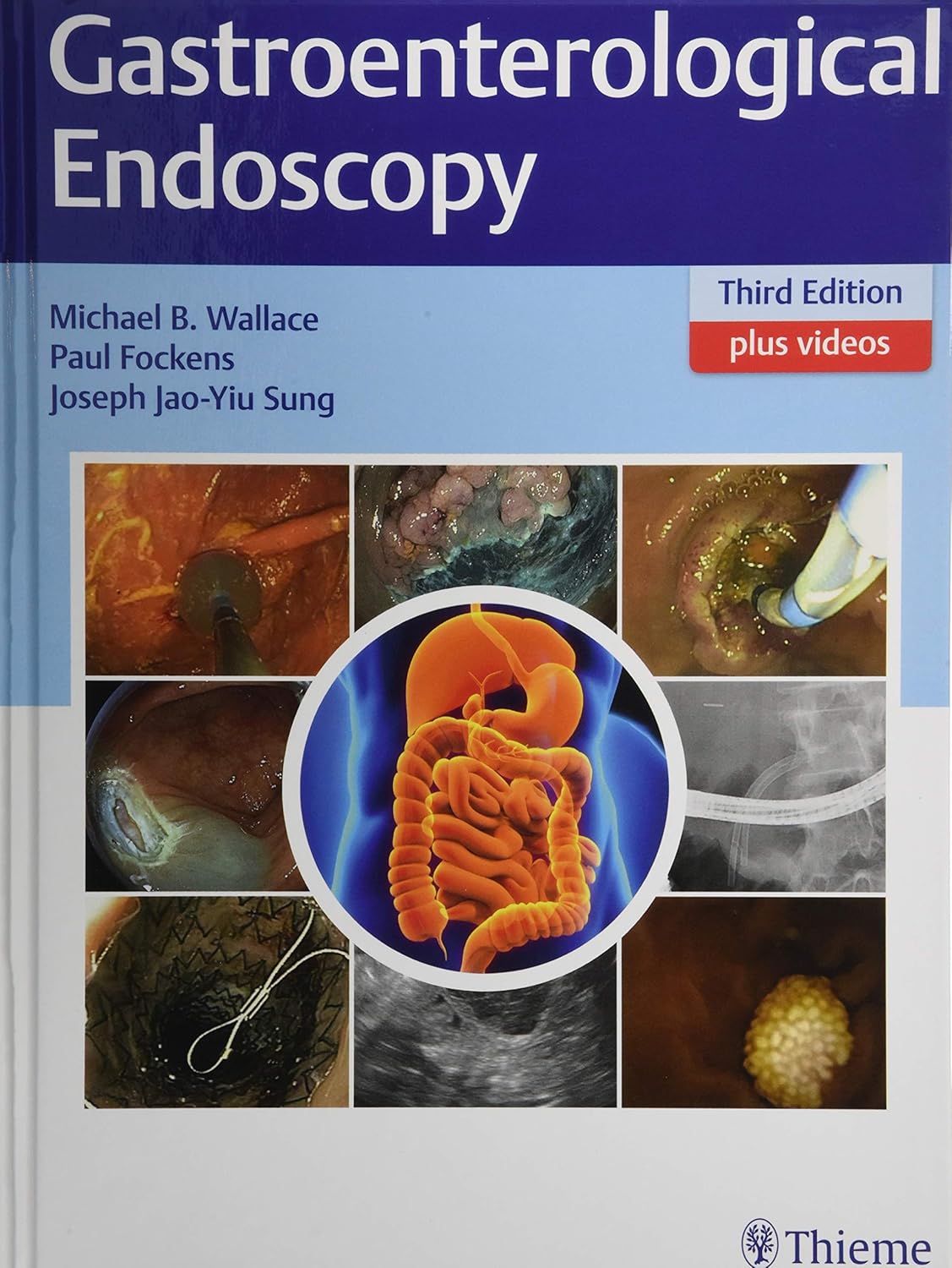 Gastroenterological Endoscopy (Wallace) 3rd edition (2018)