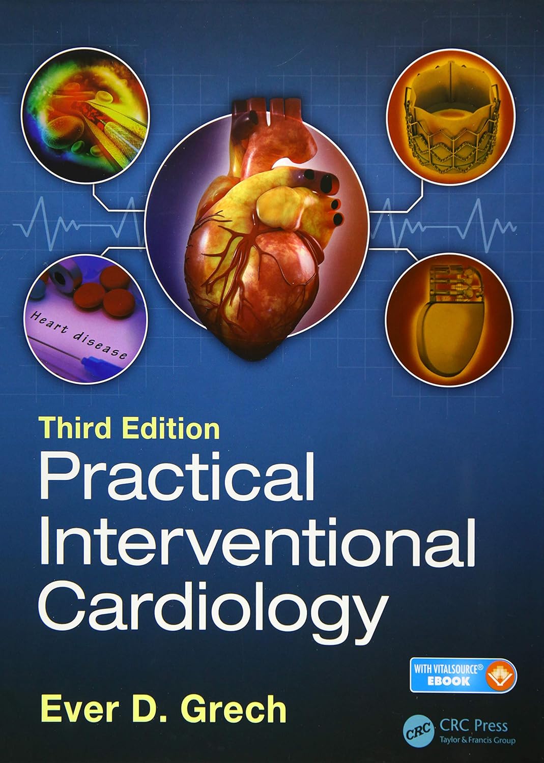 Practical Interventional Cardiology (Grech) 3rd edition (2018)