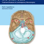 Meningiomas of the skull base. Treatment nuances in contemporary neurosurgery(Cappabianca) 1st edition (2018)