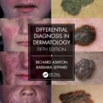 Differential Diagnosis in Dermatology (Ashton) 5th edition (2021)