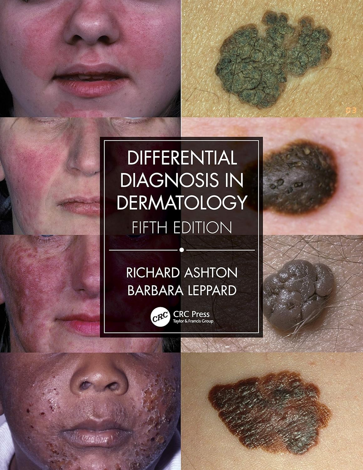 Differential Diagnosis in Dermatology (Ashton) 5th edition (2021)