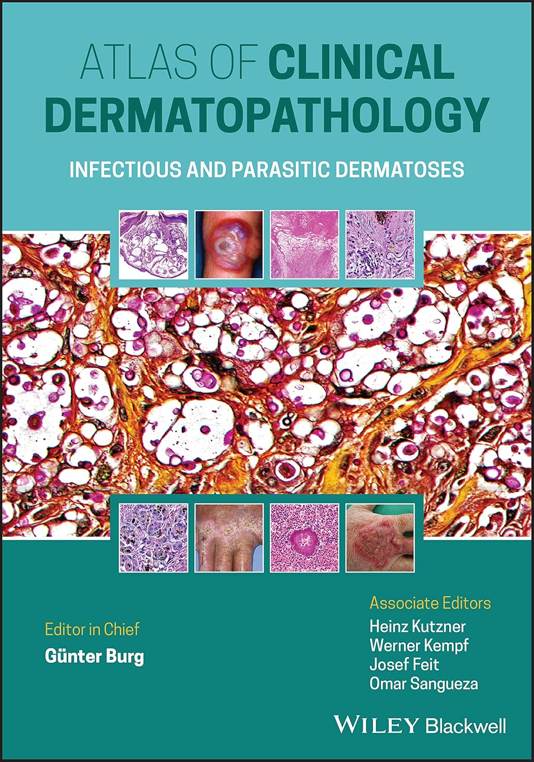 Atlas of Clinical Dermatopathology. Infectious and Parasitic Dermatoses (Burg) 1st edition (2021)