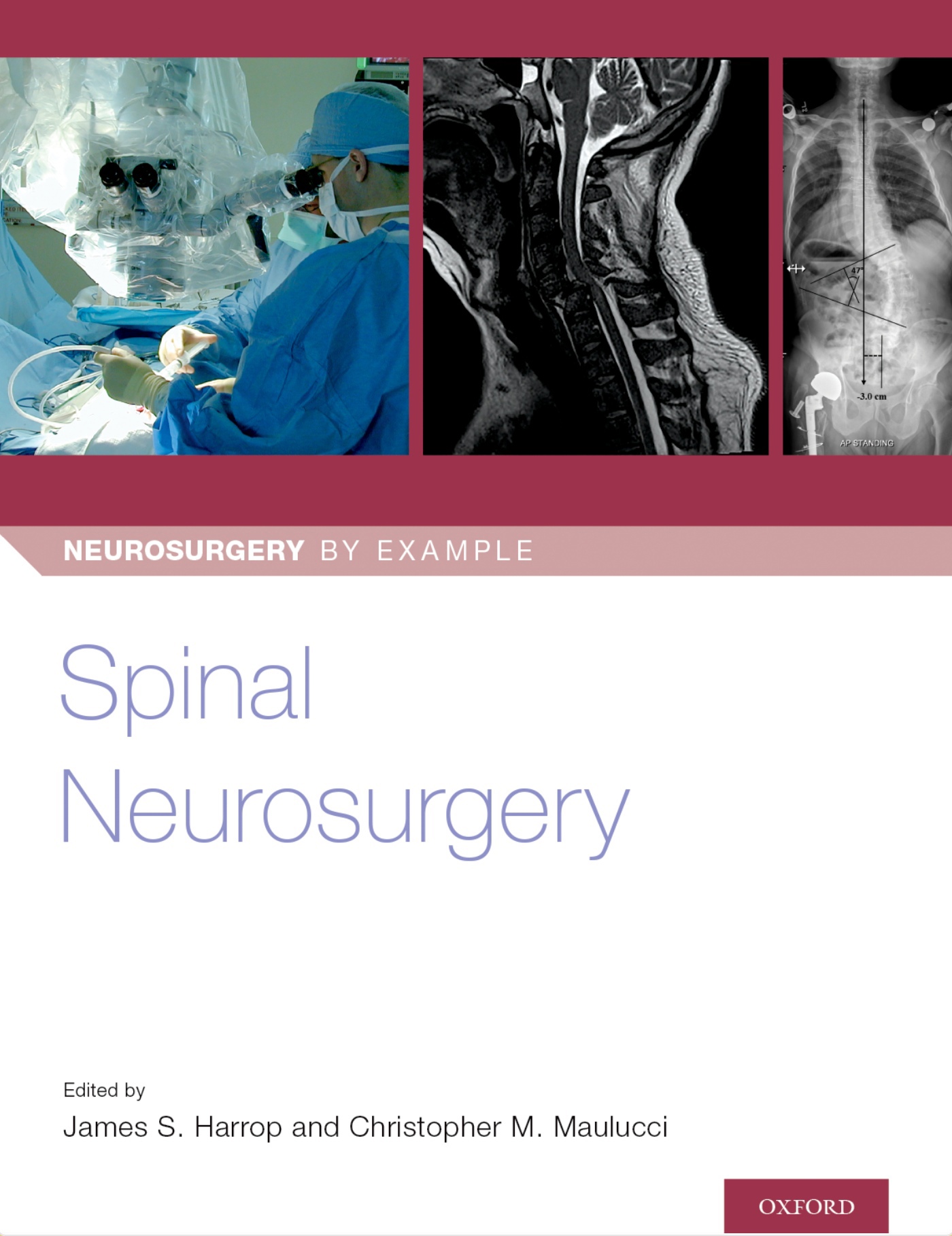 Spinal Neurosurgery (Harrop) 1st edition (2019)