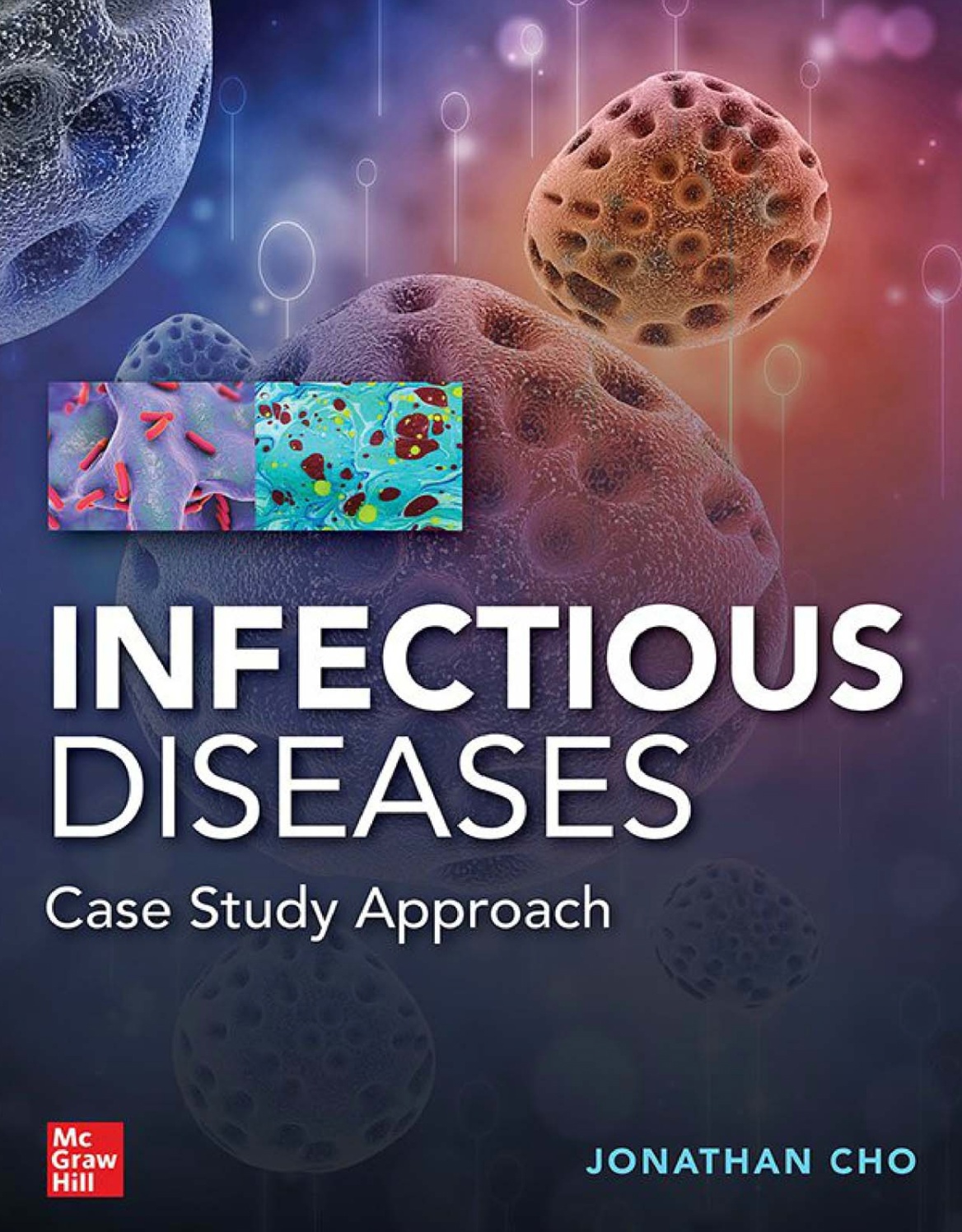 Infectious Diseases. A Case Study Approach (Cho) 1st edition (2020)