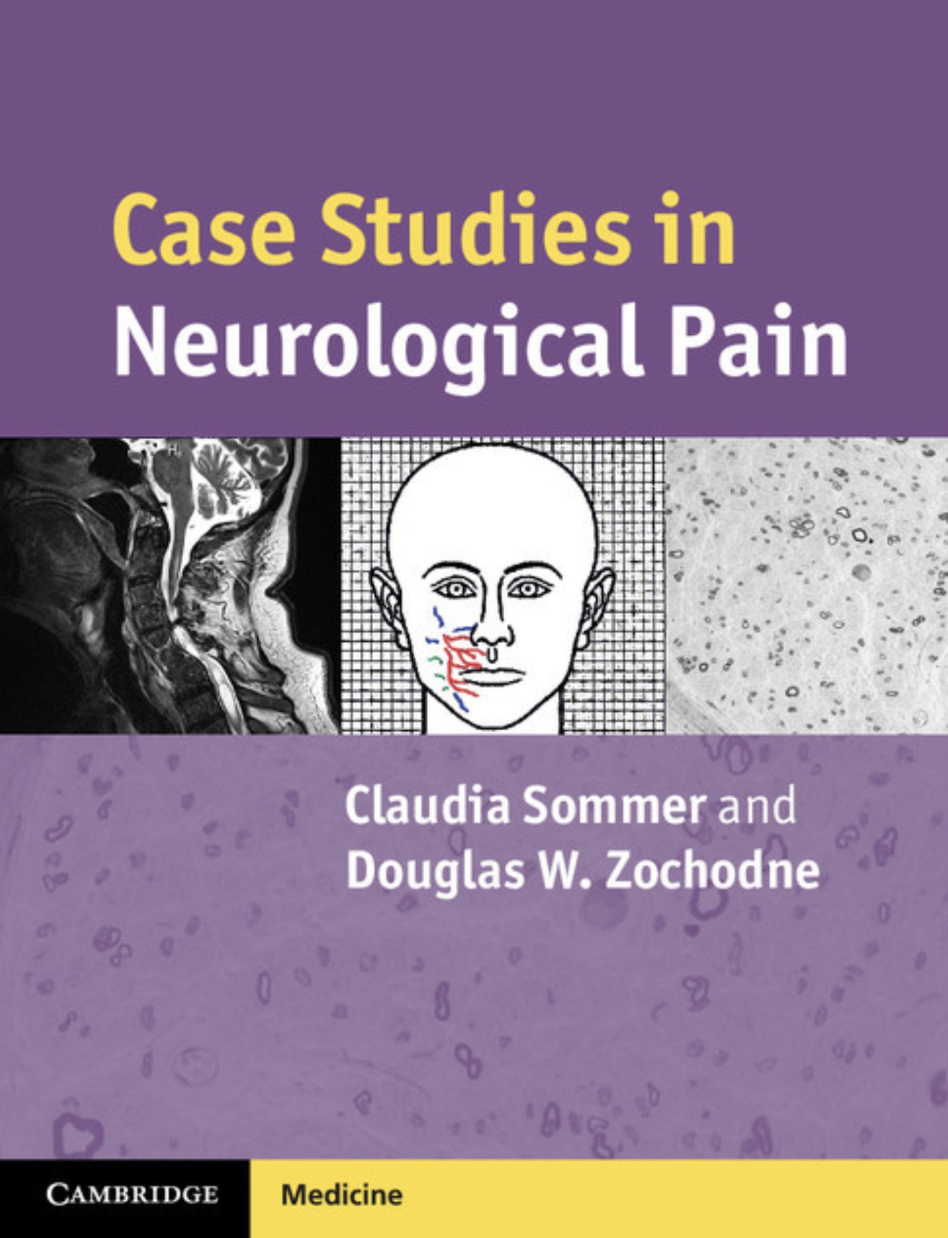 Case studies in neurological pain (Sommer) 1st edition (2012)