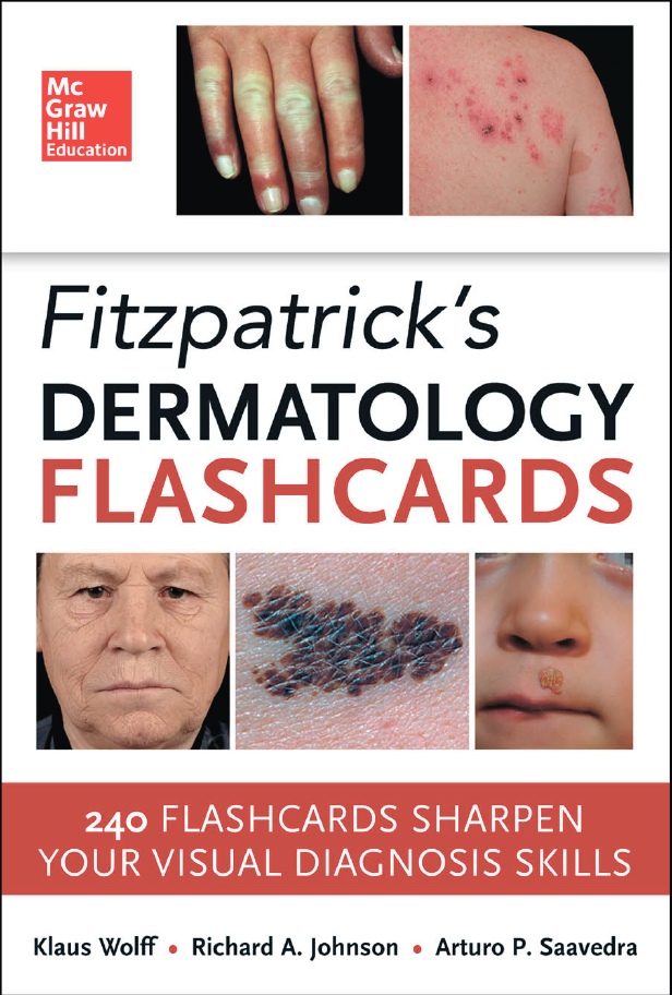 Fitzpatrick’s Dermatology Flashcards (Wolff) 1st edition (2014)