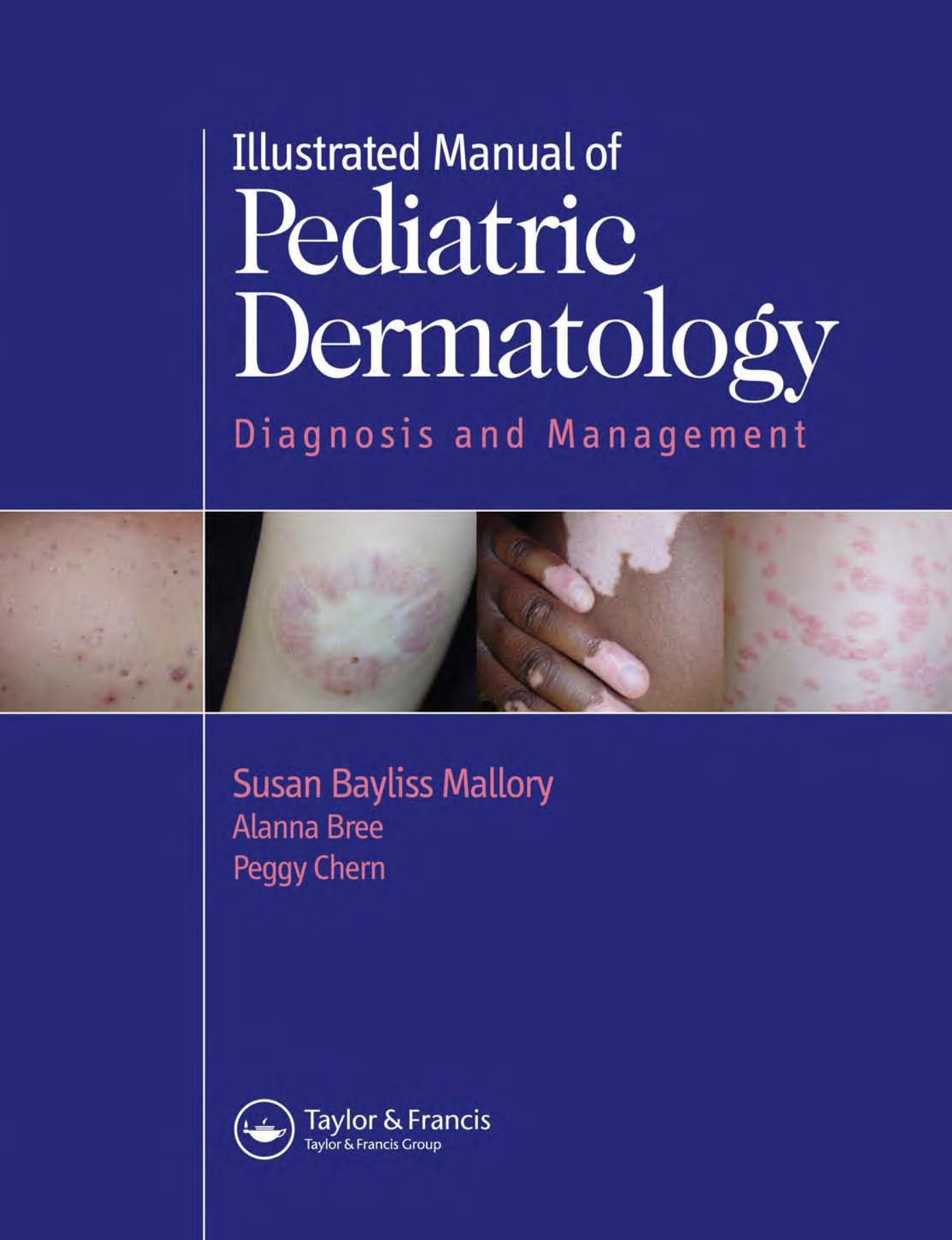 Illustrated Manual of Pediatric Dermatology Diagnosis and Management (Mallory) 1st edition (2005)