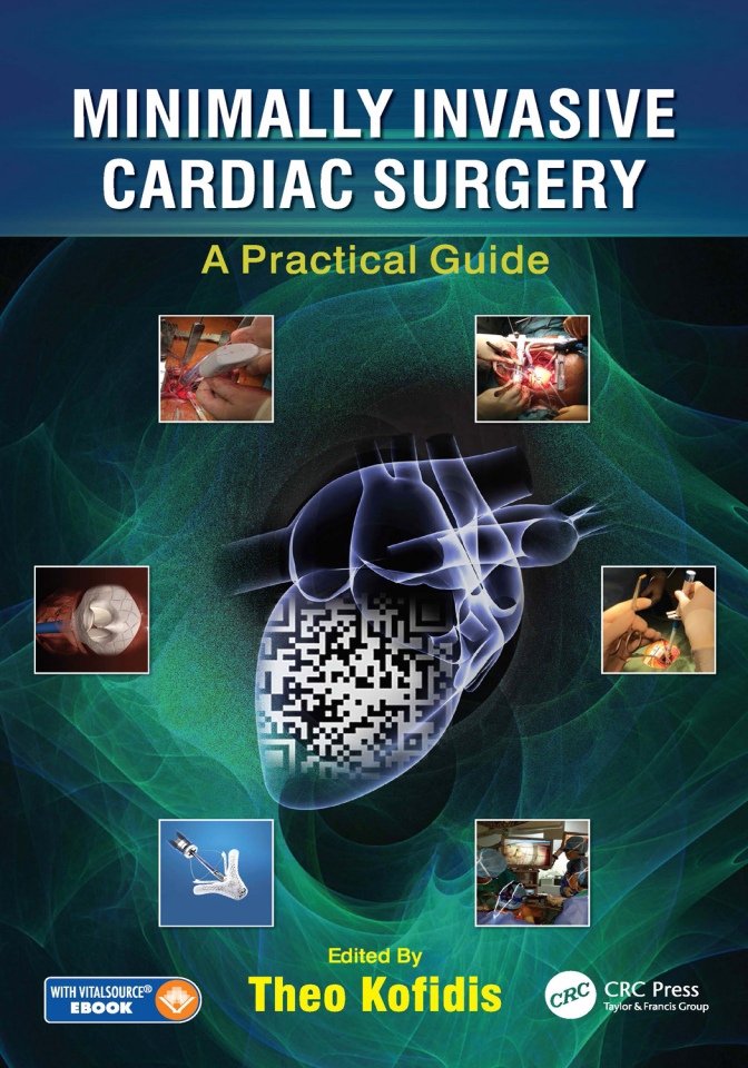 Minimally Invasive Cardiac Surgery: A Practical Guide (Kofidis) 1st edition (2021)