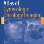 Atlas of Gynecologic Oncology Imaging (Akin) 1st edition (2014)