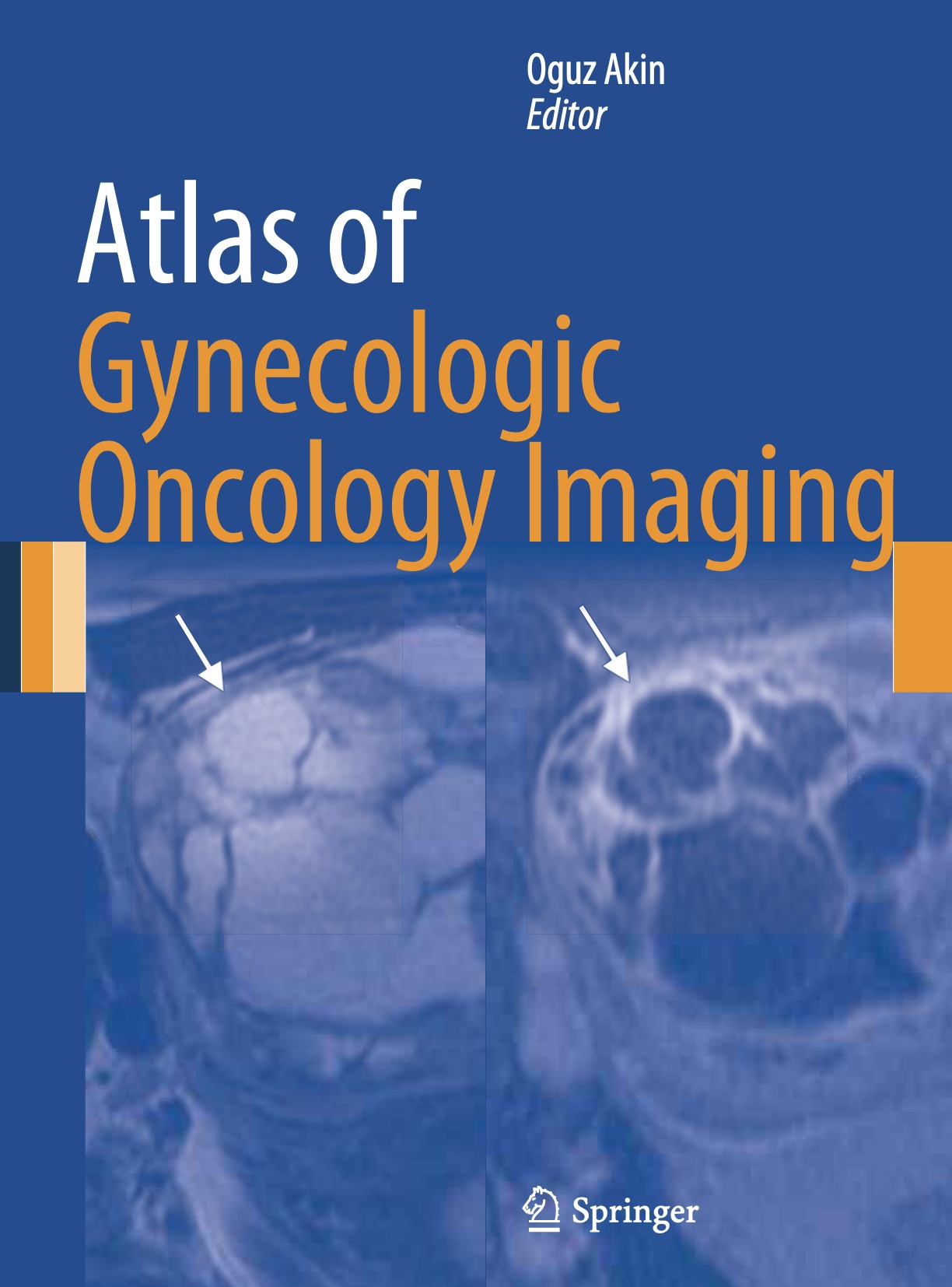 Atlas of Gynecologic Oncology Imaging (Akin) 1st edition (2014)