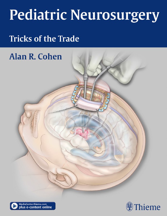 Pediatric Neurosurgery – Tricks of the Trade (Cohen) 1st edition (2016)