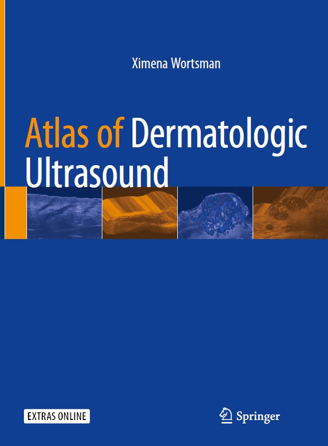 Atlas of Dermatologic Ultrasound (Wartsman) 1 ed (2018)