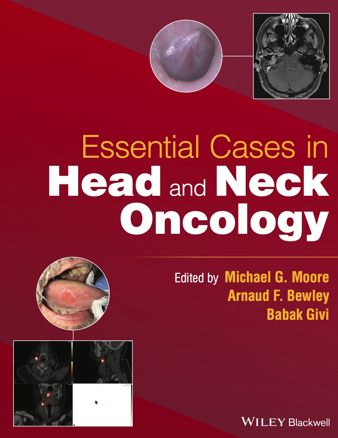 Essential Cases in Head and Neck Oncology (Moore) 1st edition (2022)