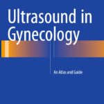 Ultrasound in Gynecology. An Atlas and Guide (Sibal) 1st edition (2017)