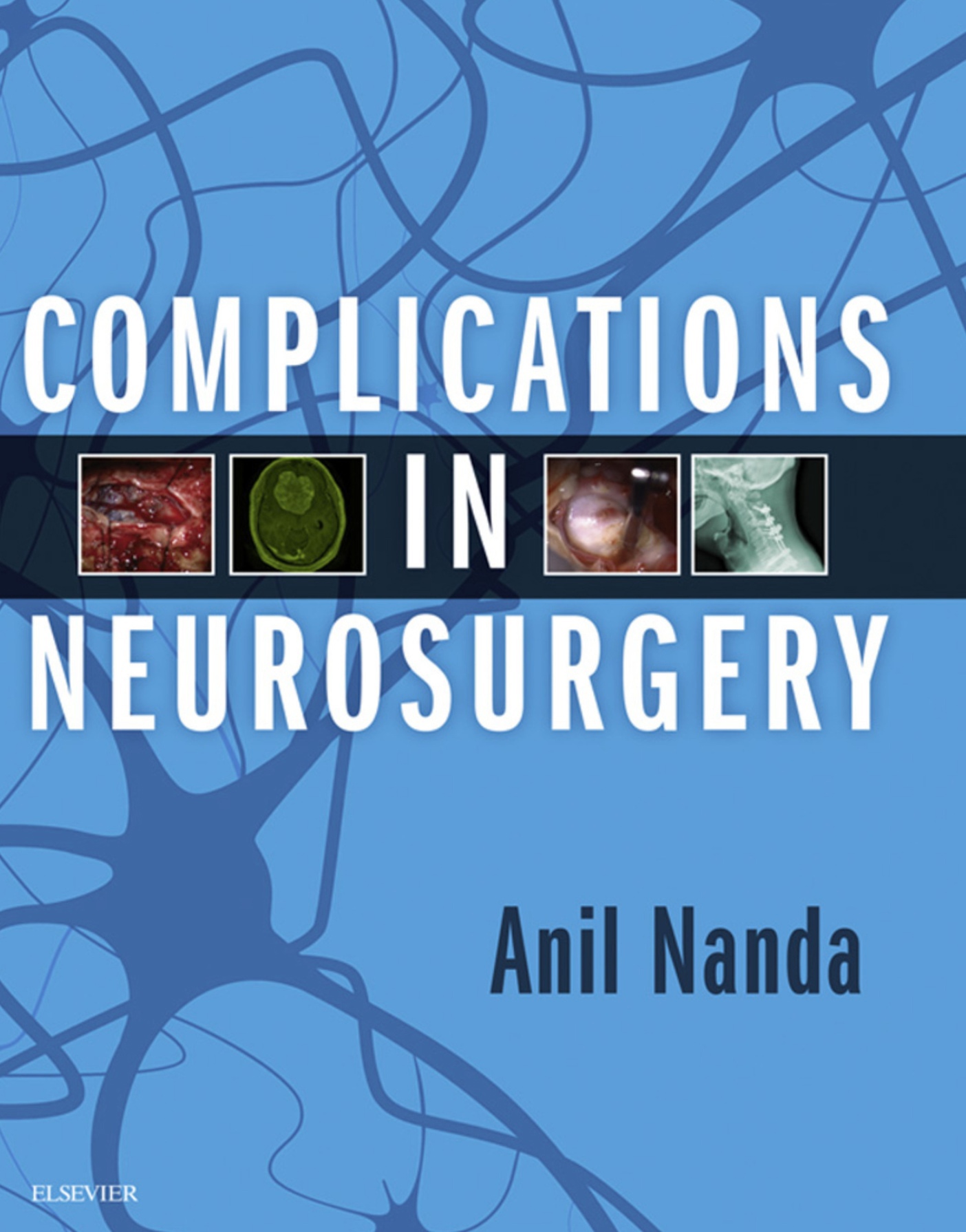 Complications in Neurosurgery (Nanda) 1st edition (2019)