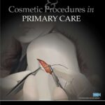 Dermatologic Surgery and Cosmetic Procedures in Primary Care Practice (Kantor) 1st edition (2021)