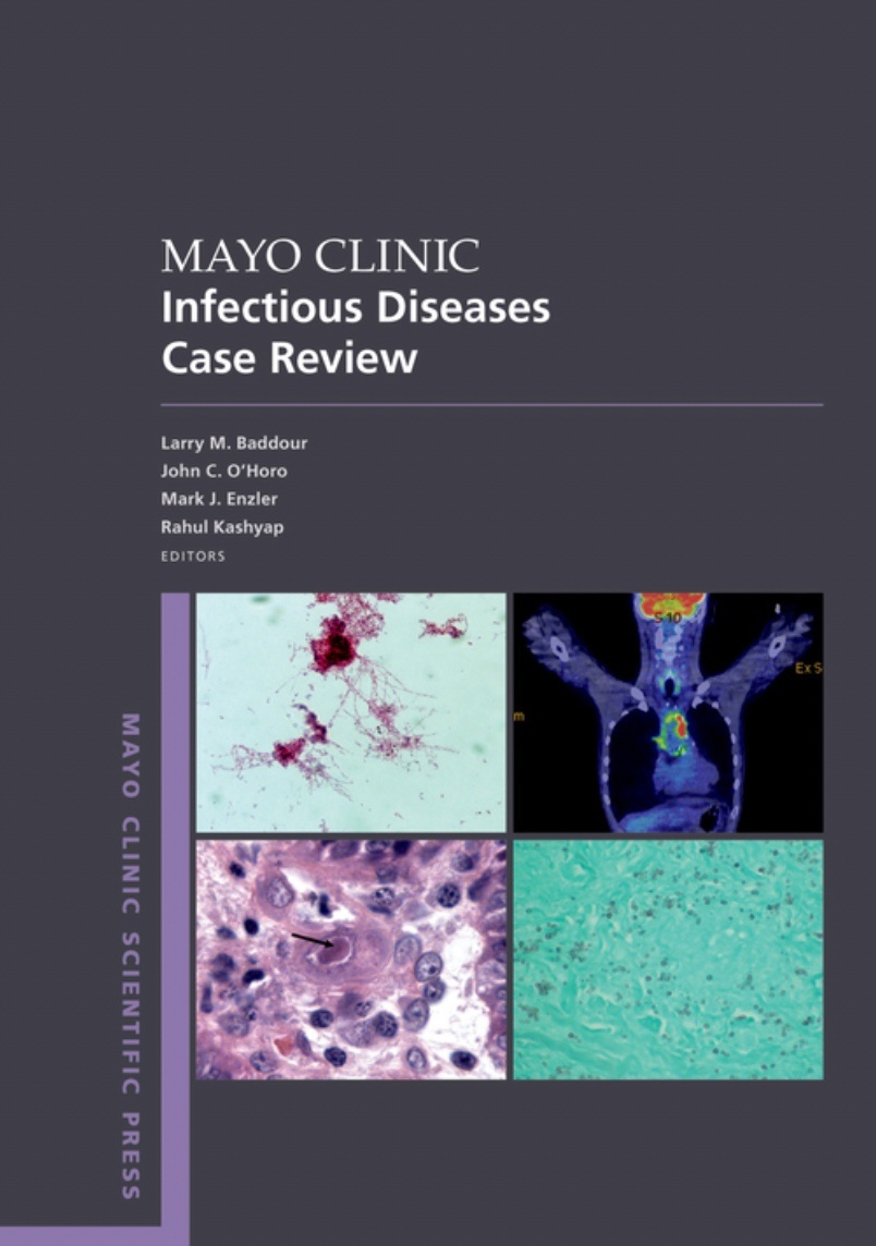 Mayo Clinic Infectious Disease Case Review. With Board-Style Questions and Answers (Baddour) 1st edition (2022)