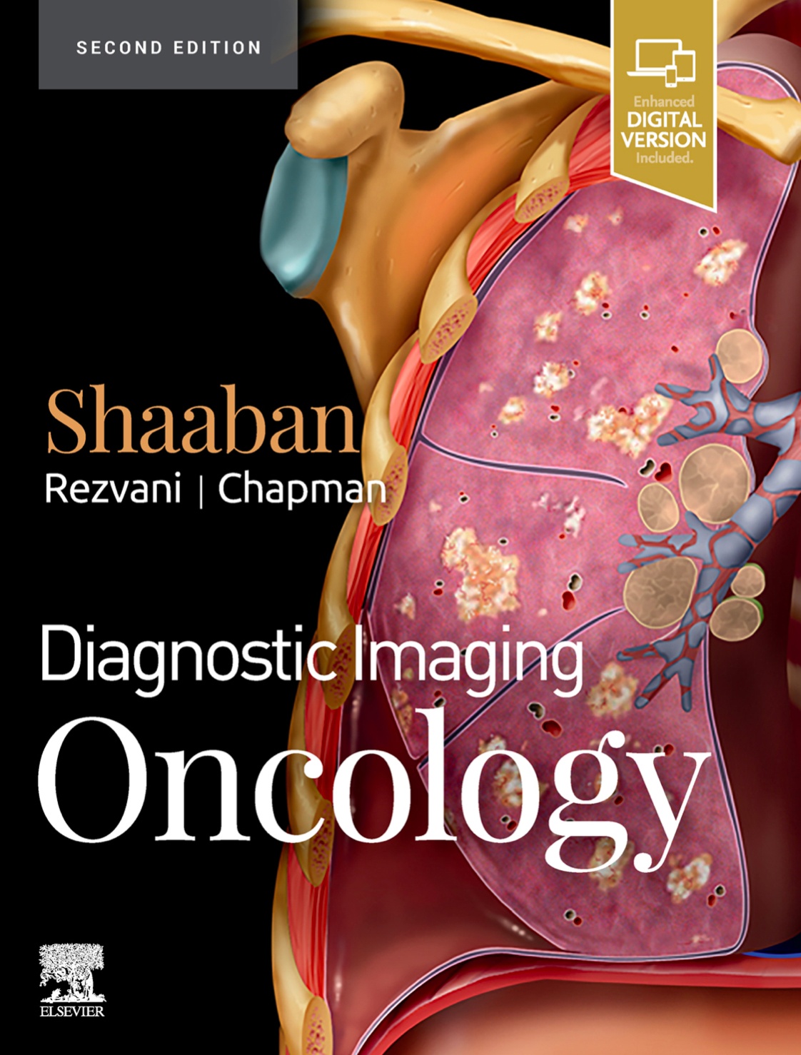 Diagnostic Imaging. Oncology (Shaaban) 2nd edition (2020)