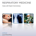 Challenging Concepts in Respiratory Medicine. Cases with Expert Commentary (Schomberg) 1st edition (2017)