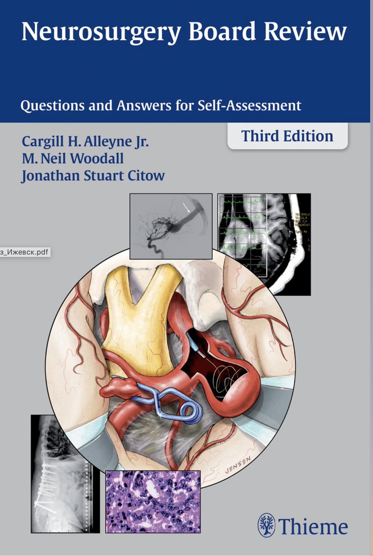 Neurosurgery Board Review. Questions and Answers for Self-Assessment (Alleyne) 3rd edition (2016)