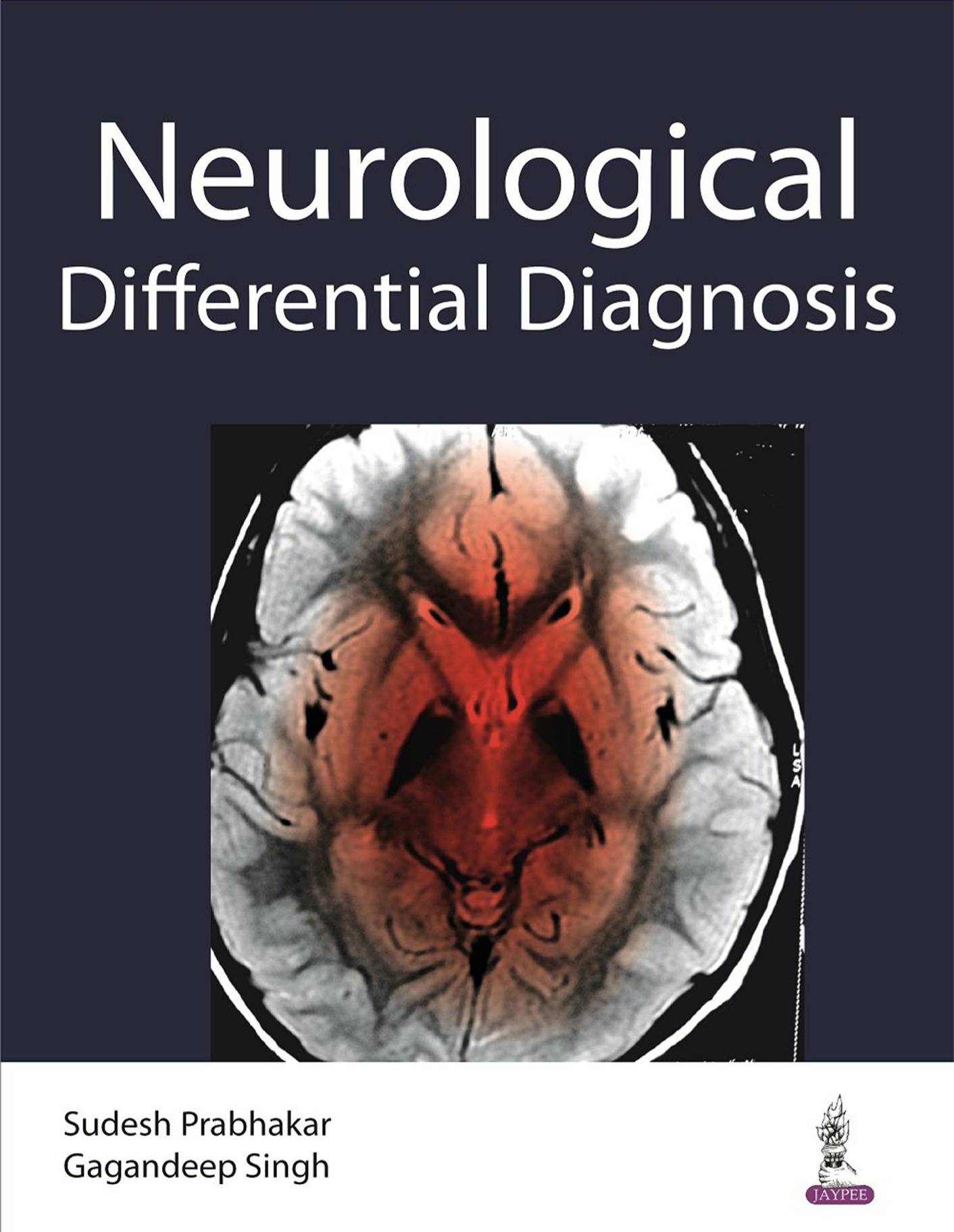 Differential Diagnosis in Neurology (Prabhakar) 1st edition (2016)