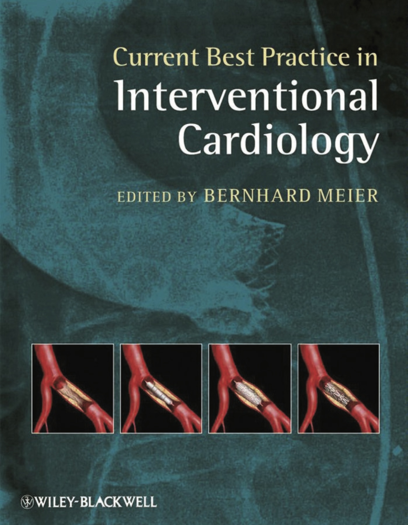 Current Best Practice in Interventional Cardiology (Meier) 1st edition (2010)